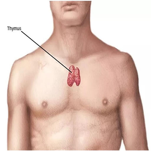 thymoma & myasthenia